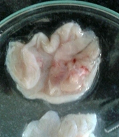Gene Cell Tissue